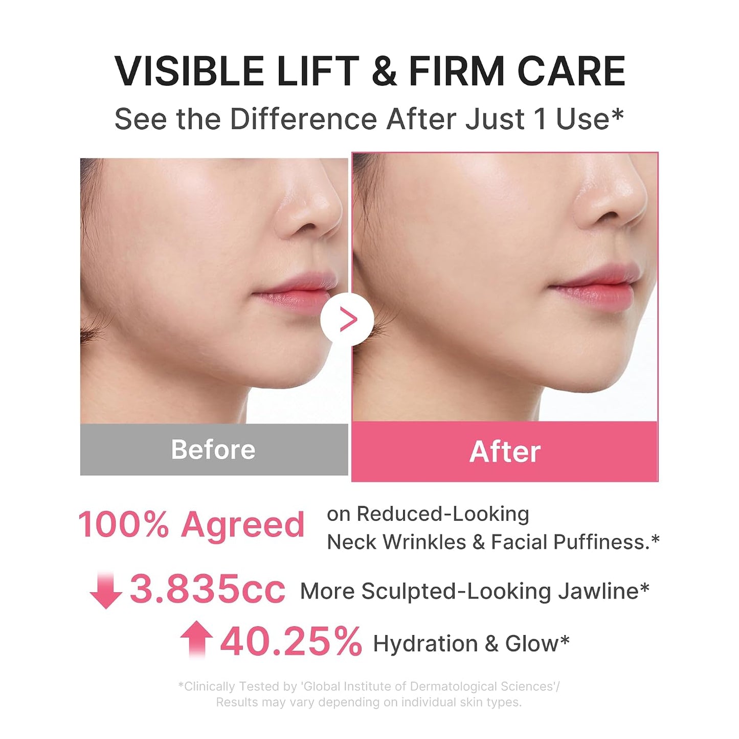 Medicube PDRN Collagen Gua Sha Neck Wrinkle Cream | Built-In Gua Sha Massager with Volufiline 5% + PDRN | Korean Skincare