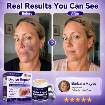 👨‍⚕️Over 100,000 units sold💕 - Cream to repair bruises and strengthen the skin.