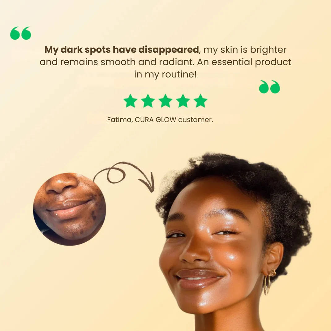 ✨ Advanced Anti-Spots & Dark Spot Correcting Soap — Hyperpigmentation Treatment for Face & Body, Melasma Fade Bar 🧼