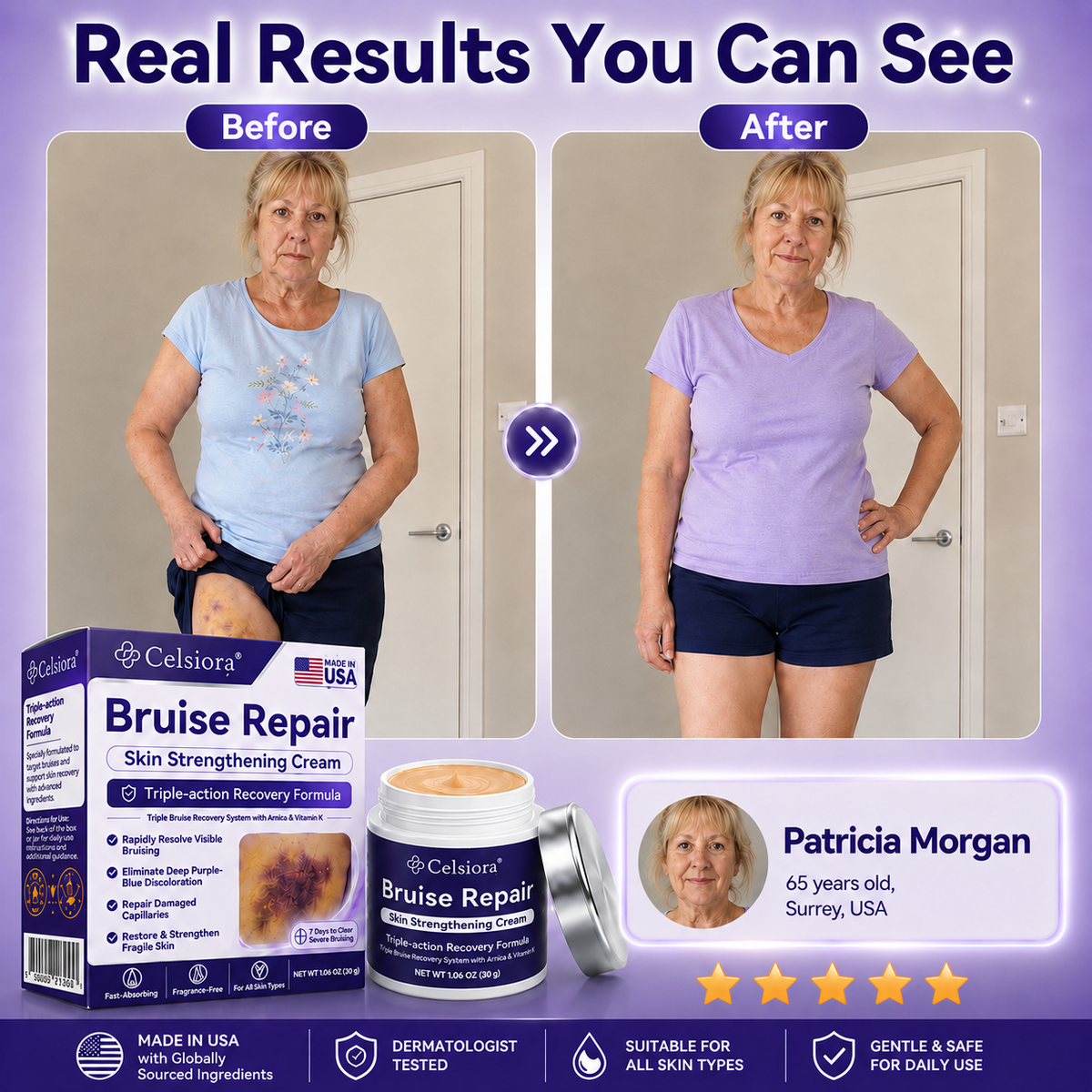 👨‍⚕️Over 100,000 units sold💕 - Cream to repair bruises and strengthen the skin.