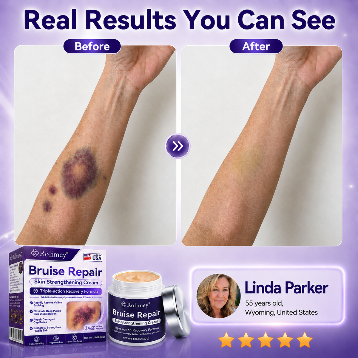 👨‍⚕️Over 100,000 units sold💕 - Cream to repair bruises and strengthen the skin.