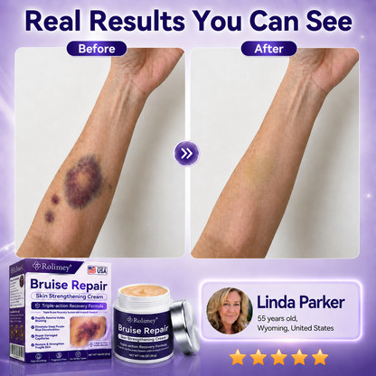 👨‍⚕️Over 100,000 units sold💕 - Cream to repair bruises and strengthen the skin.