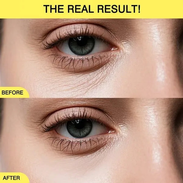Revitalizing Eye & Face Cream with Probiotics, Retinal & Peptides – 40ml