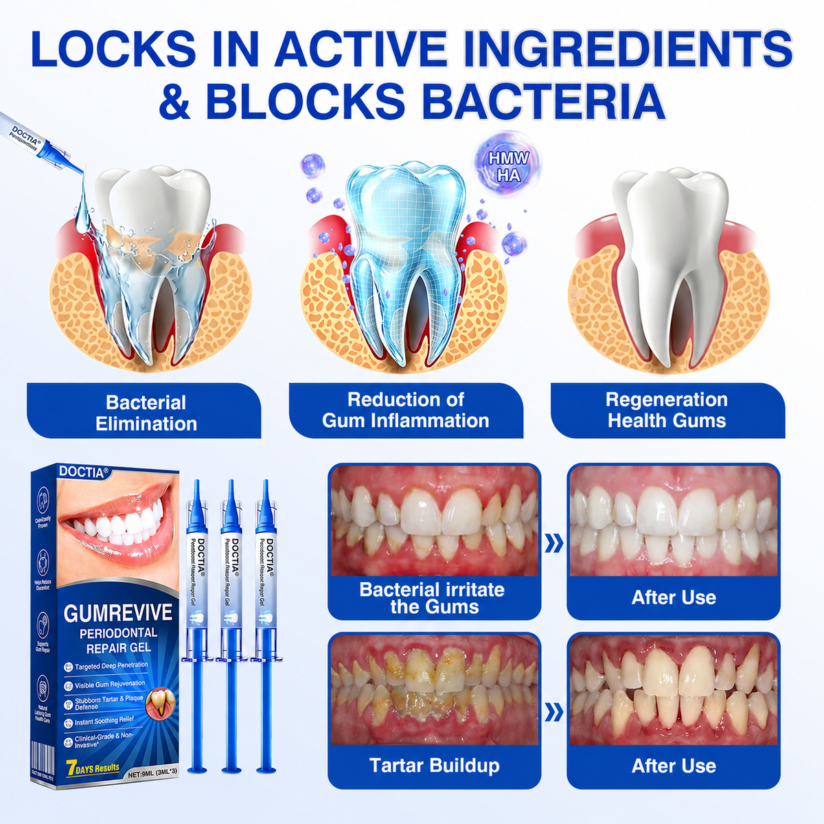 🏅🦷🛡️ DOCTIA® GumRevive Advanced Gum Care & Repair Gel🌞