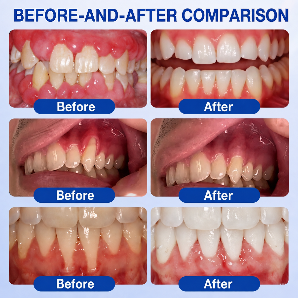 🏅🦷🛡️ DOCTIA® GumRevive Advanced Gum Care & Repair Gel🌞